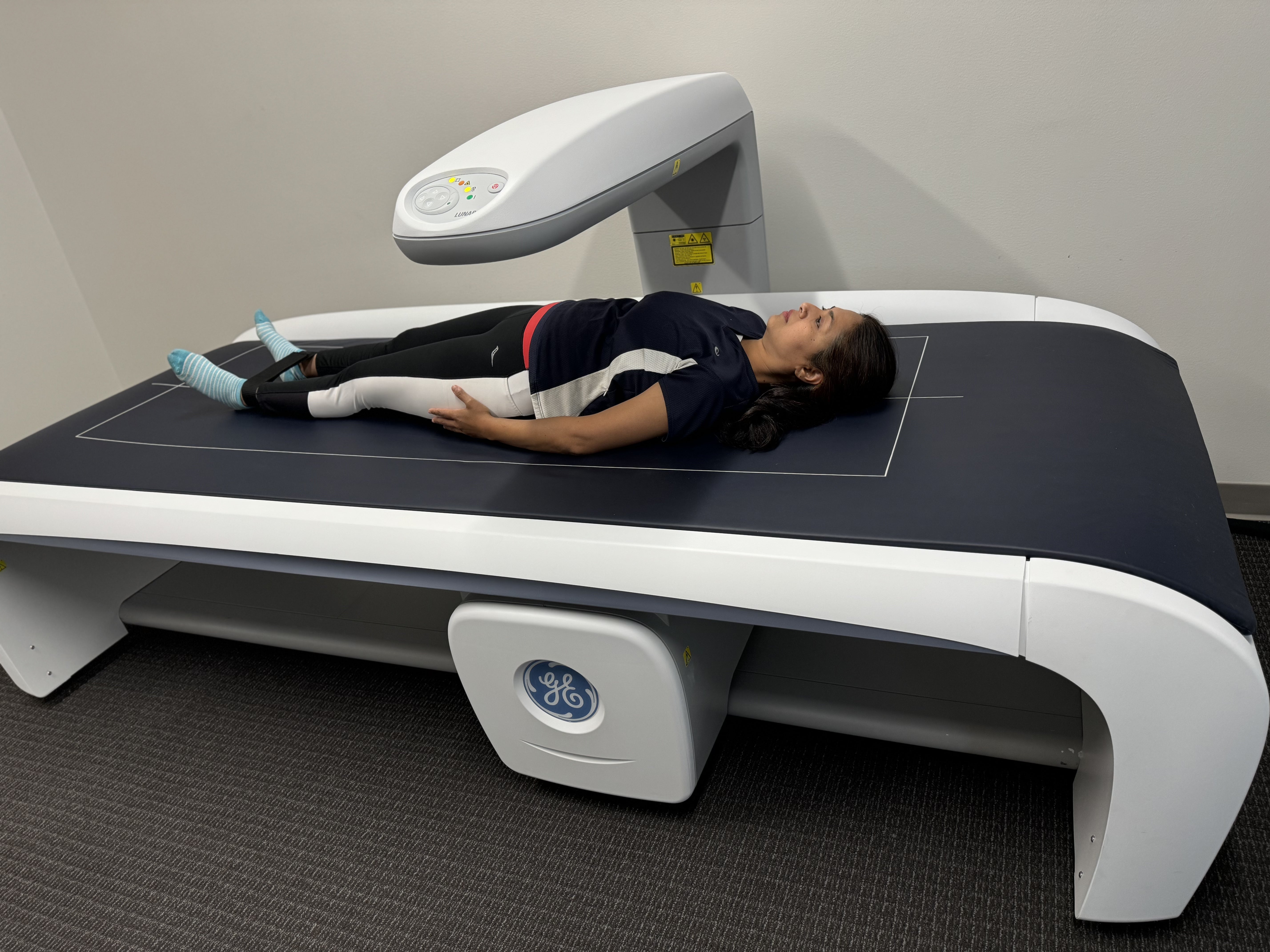 DEXA Scan